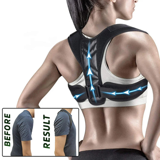 Back & Shoulder Posture Corrector – Unisex, Adjustable